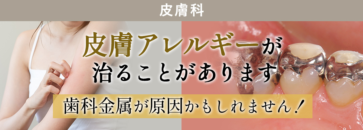 皮膚アレルギー治療