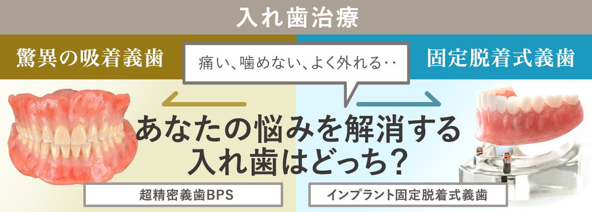 入れ歯治療
