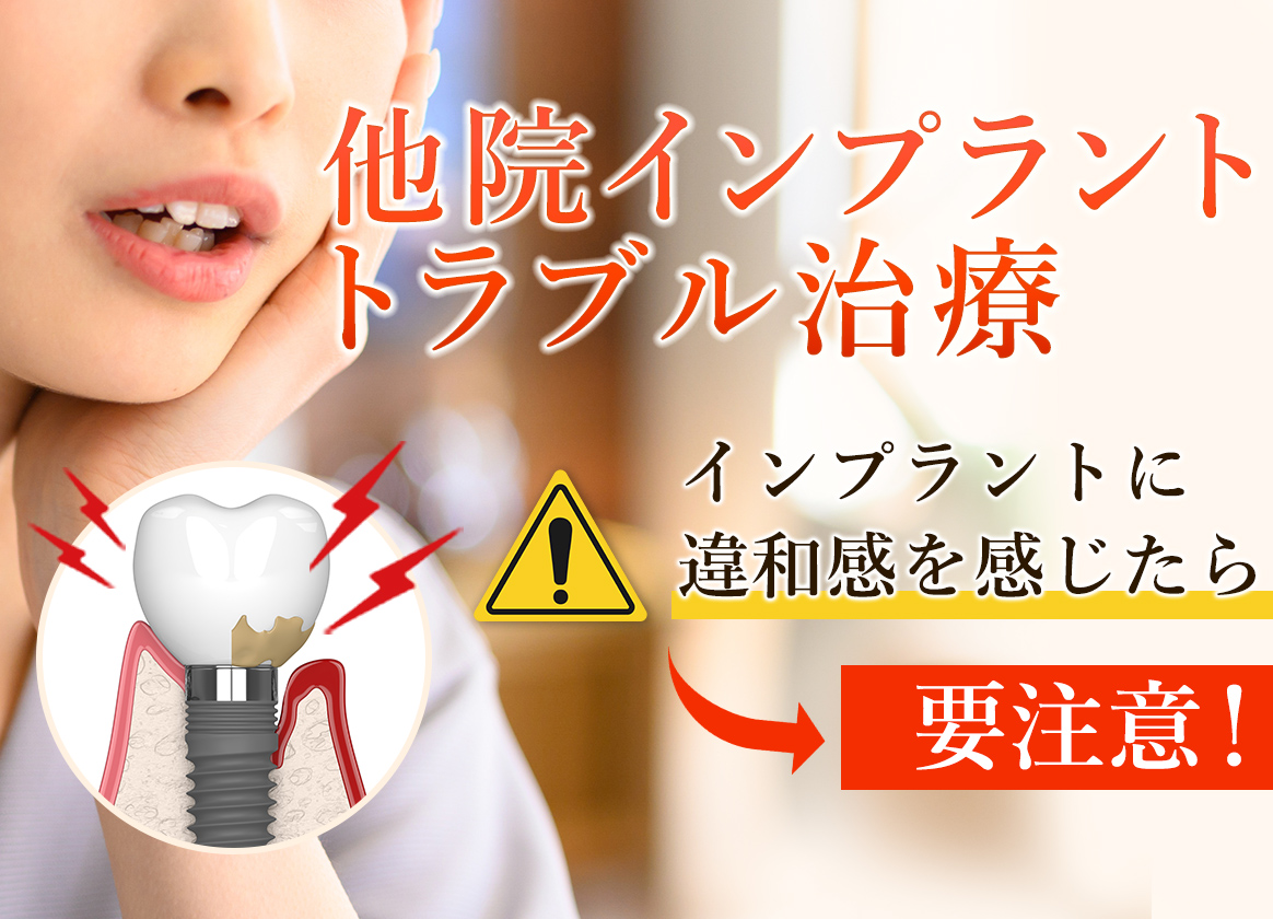 他院インプラント・トラブル治療