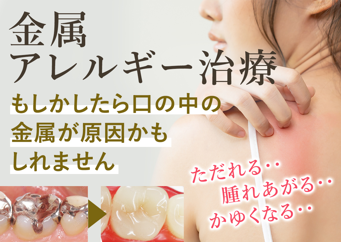 皮膚アレルギー治療